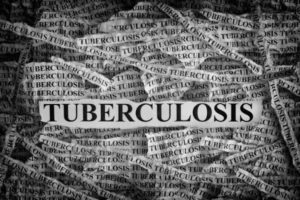 USAID: Accelerate Tuberculosis Elimination and Program Resilience Activity in South Africa
